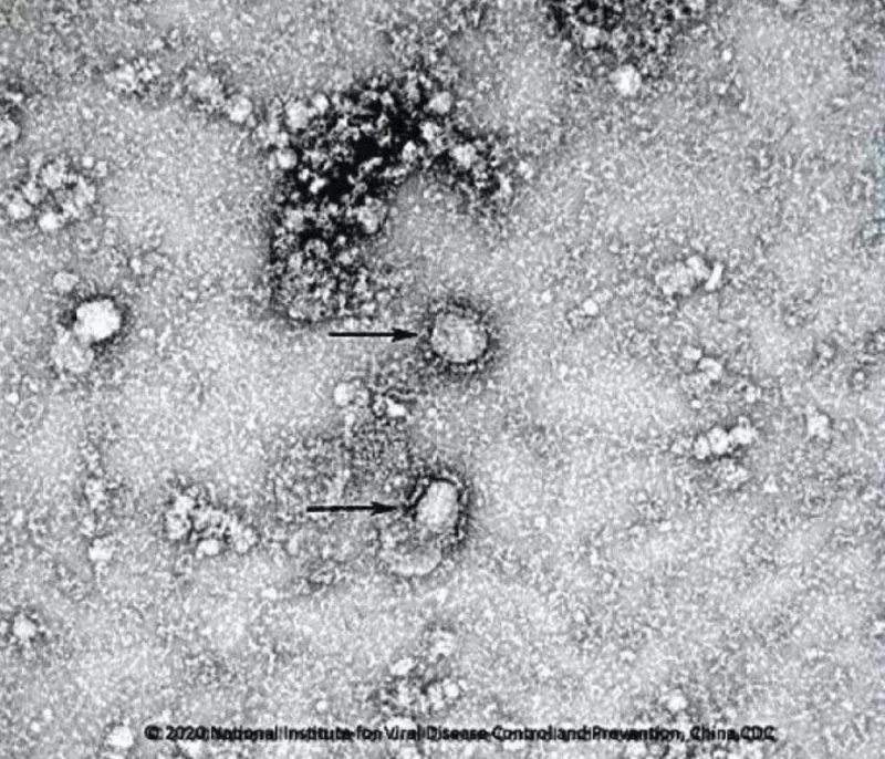 ▲新型冠狀病毒武漢株01。照片來(lái)源：國(guó)家病原微生物資源庫(kù)（中國(guó)疾病預(yù)防控制中心病毒病預(yù)防控制所）